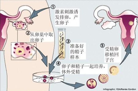 林靜遠
